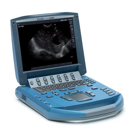 SONOSITE MICROMAXX Ultrasound (Portable) - Medicare Exel