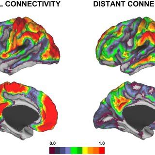 Local Disconective 的图像结果