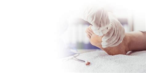 Image result for Toe Surgery