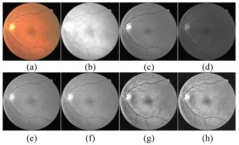 Automatic Retinal Blood Vessel Segmentation Based on Fully ...