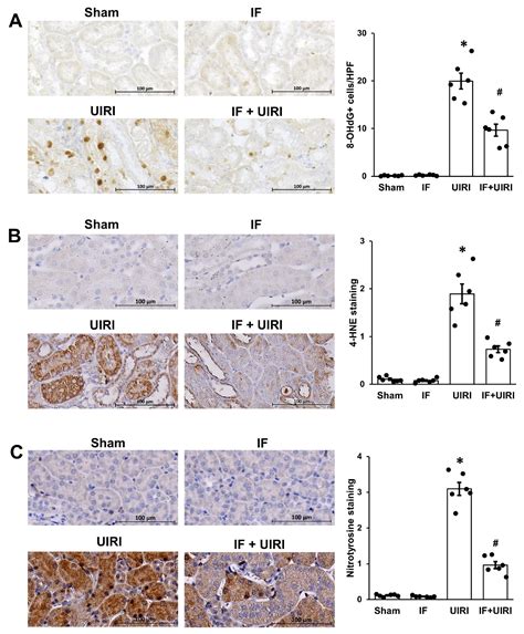 Intermittent Fasting Protects Against the Progression from Acute Kidney ...