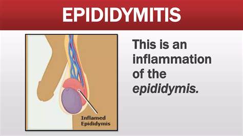 Common Disorders and Ailments of the Reproductive System | PPTX