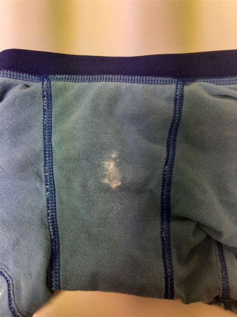 I'm hoping someone can relate. Ds white stuff on underwear. | BabyCenter