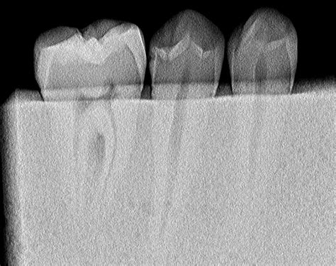 Image result for Convolution Emboss Filter