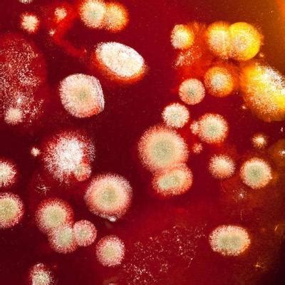 组织病理学何时可能是「侵袭性真菌病」唯一的重要诊断手段？检测霉菌感染时又有哪些优点和局限？-头条-呼吸界