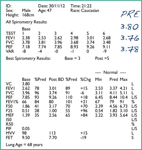 Spirometry Normal Values Chart 的图像结果
