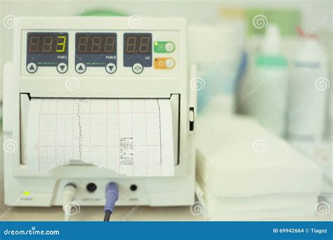Fetal Heartbeat Monitor, Cardiotocography Stock Photo - Image of afraid, curves: 69942664