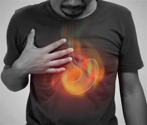 Does Milk Help with Heartburn? A Clinical Perspective