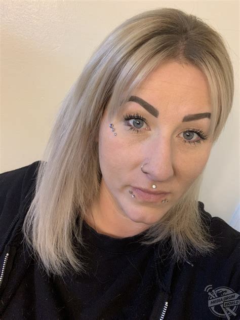 Image result for Hair Splinter Infection