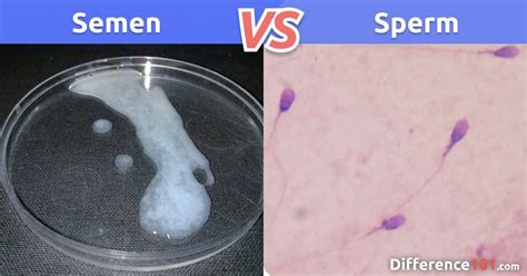 Semen vs. Sperm: Key Differences and FAQ | Difference 101