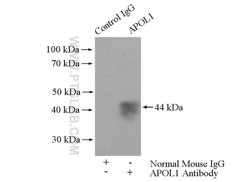 APOL1-Specific antibody (66124-1-Ig) | Proteintech