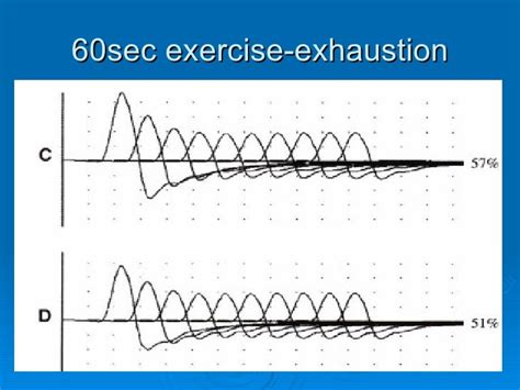 Image result for Repetitive Nerve Stimulation Test