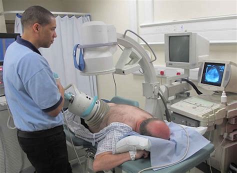 Lithotripsy, laser lithotripsy procedure, recovery & lithotripsy side ...