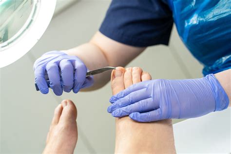 Nail care and toenail cutting | Total Foot Health