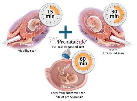 Image result for Fetal Bleed Screen Kit Parallel Testing