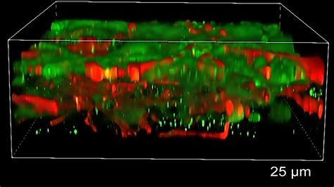 Image result for Brain Tissue Sample