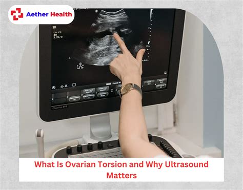 Ovarian Torsion Ultrasound: Key Signs, Findings & Diagnostic Accuracy