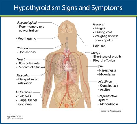 Hypothyroidism Signs and Symptoms From: http://nurseslabs.com/hypothyroidism/ Thyroid Disease ...