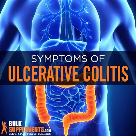 Is Colitis Contagious