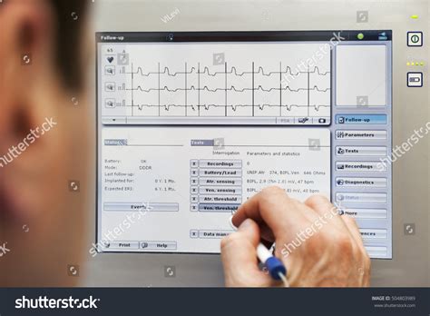 Image result for Merlin Pacemaker Monitor