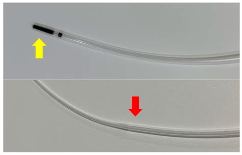 Efficacy of a Novel Tapered Contrast Catheter for Endoscopic Ultrasound ...
