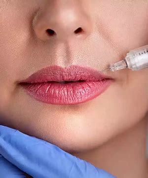 Best Botox Injection Treatment for Youthful Skin in Chennai