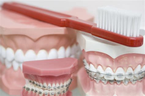 The Ultimate Guide to Adult Braces: Louisville Orthodontists