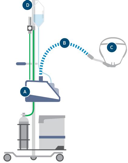 Image result for Airvo 2 FiO2