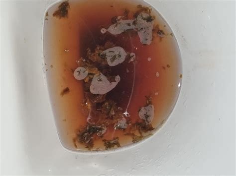 Foamy black(ish) diarrhea? : r/poop