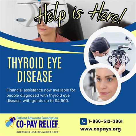 Can you treat thyroid eye disease? Grant awards up to $4500. | Patient Advocate Foundation ...