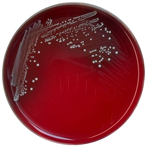Genomic Characterization and Safety Evaluation of Enterococcus lactis ...