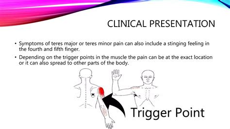 Teres Major and Minor Pain | PPTX