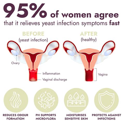 White Discharge Yeast Infection BV Vs Yeast Infection: What You Need