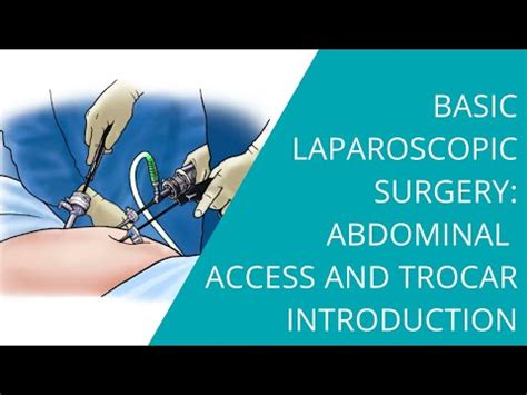 Laparoscopic Instruments and Open Surgery Instrument Manufacturer ...