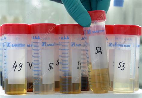 Image result for One Lab Samples