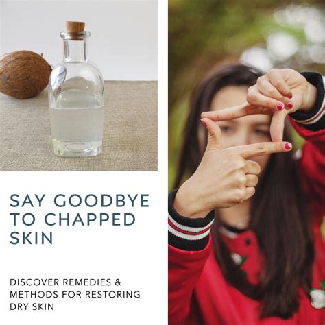 Best Remedy For Dry Chapped Skin at Milla Slessor blog