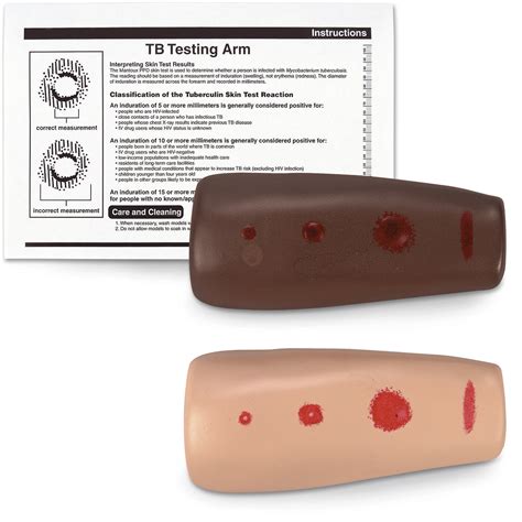TB Testing Arm – Nasco Healthcare