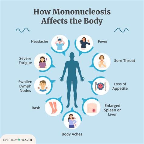How to Prevent Mono and Avoid Infection
