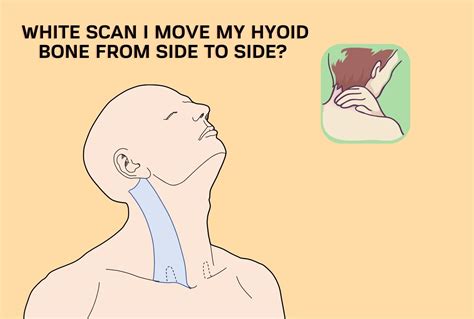 Hyoid Bone Pops Out of Place – (Hyoid Syndrome, Dislocations, and ...