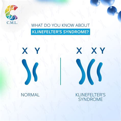 Colors Medical Laboratories on LinkedIn: Klinefelter syndrome is a ...