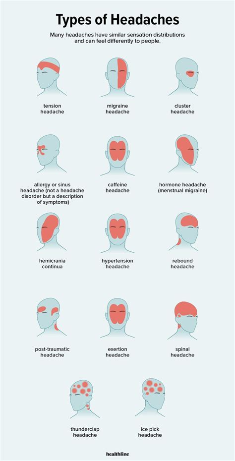 Types of Headaches: Symptoms, Causes, Treatments, and More | Headache ...