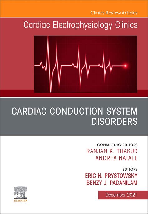 Image result for Cardiac Conduction System Disorders