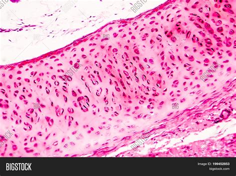 Hyaline Cartilage Under Microscope