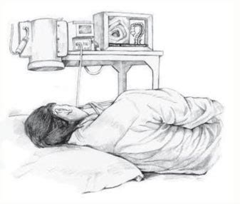 Image result for Difficult Colonoscopy