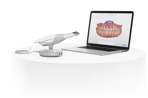 The Trios 3Shape Scanner: Revolutionizing Dental Impressions