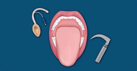 Image result for Das Difficult Airway Algorithm