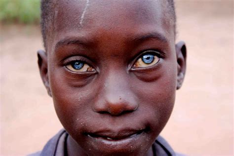 Unveiling the Enigma: Can Africans Possess Azure Eyes?