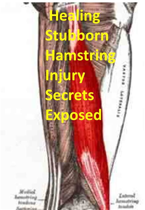 Pulled Hamstring 的图像结果