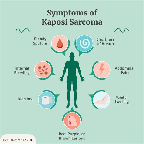 Understanding The Extreme Case Of Kaposi Sarcoma Symptoms