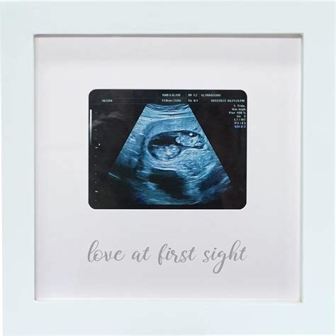Amazon.com: HAMUIERS Love at First Sight Ultrasound Picture Frames, Sonogram Picture Frame ...
